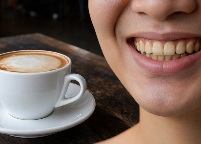 Minum Kopi Setiap Hari? Jangan Biarkan Senyum Kehilangan Kilau