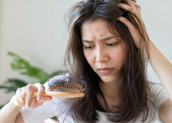 Bukan Cuma Berat Badan, Makanan Berlemak Ternyata Bisa Bikin Rambut Menipis