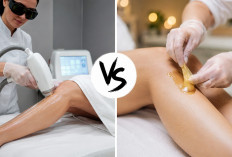Laser vs Waxing, Pilihan Terbaik untuk Kulit Mulus Tanpa Drama!