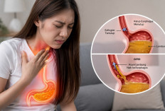 GERD Kini Ancam Anak Muda, Jangan Anggap Sepele Asam Lambung Naik!