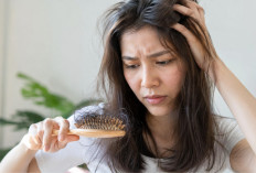 Bukan Cuma Berat Badan, Makanan Berlemak Ternyata Bisa Bikin Rambut Menipis
