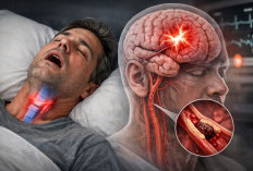 Ngorok Bisa Picu Stroke? Ini Fakta Medisnya!