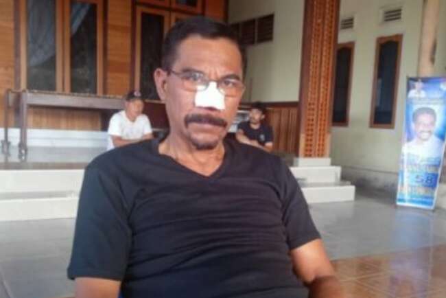 Siapa Ali Kenter? Berani Aniaya Eks Bupati Boltim di Depan Kapolres