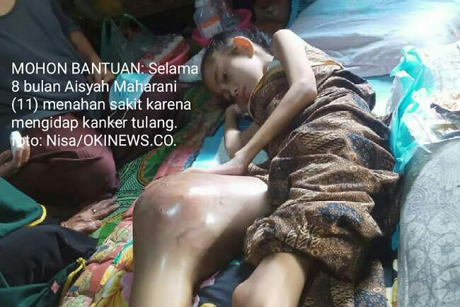 Awalnya Terbentur, Ternyata Jadi Kanker Tulang, Donasi Bisa Kesini…