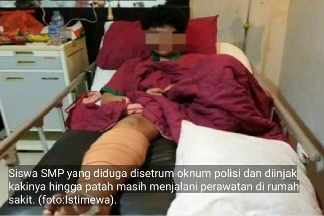 Identitas Oknum Polisi Diduga Setrum dan Patahkan Kaki Pelajar SMP Akhirnya Diungkap