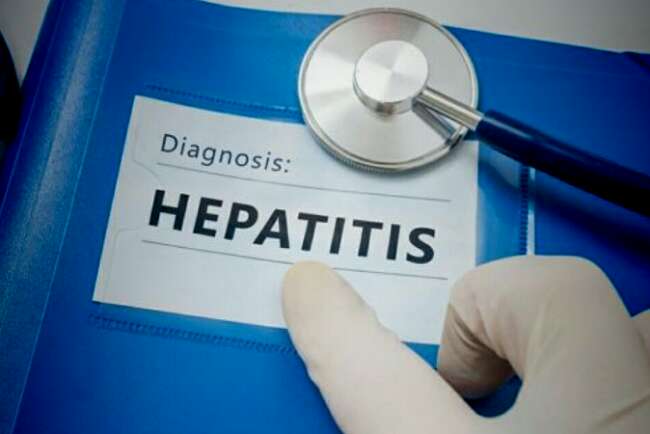 Ahli Dunia Duga Penyebab Hepatitis Misterius karena Antigen Covid-19 